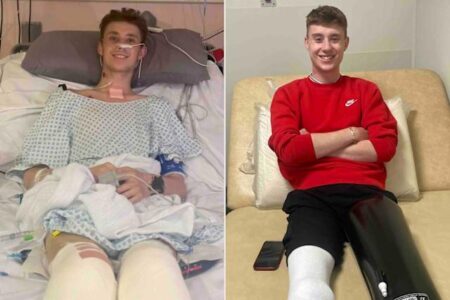 Kisah Kesehatan Perez Hilton: Tubuhku Terus Jatuh Sakit