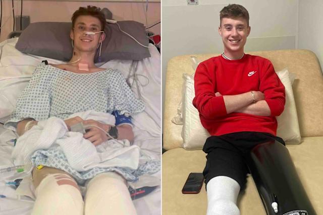 Kisah Kesehatan Perez Hilton: Tubuhku Terus Jatuh Sakit